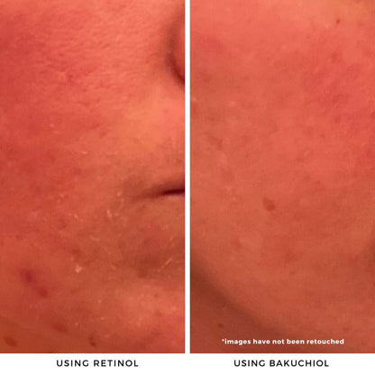 Tropical Melt Bakuchiol Cleansing Balm